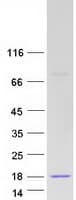 Human SNCA / Alpha-Synuclein Protein (Recombinant Myc-DDK (Flag))