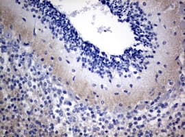 VILIP / VSNL1 Antibody (clone OTI2H3)