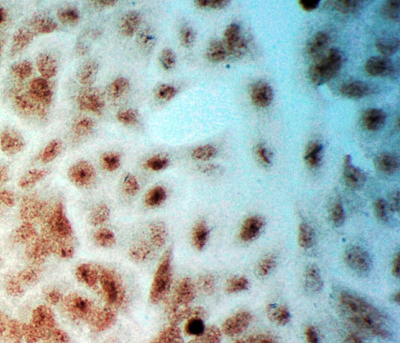 SNK / PLK2 Antibody (aa666-685)