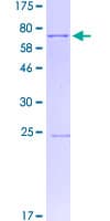 Human SGCE Protein (Recombinant GST)