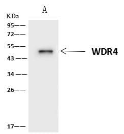 Polyclonal Rabbit anti-Human WDR4 Antibody (IHC, WB)