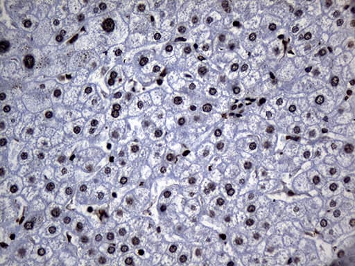 ALOX5 / 5-LOX Antibody (aa18-364, clone OTI1A1)