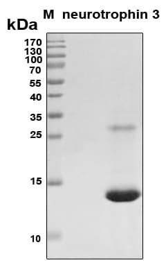 Human NTF3 / Neurotrophin 3 Protein (Recombinant 6His, N-terminus)