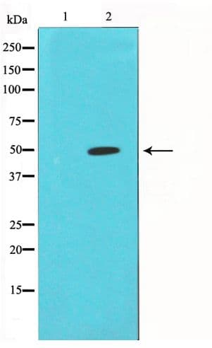Polyclonal Rabbit anti-Human FOS / c-FOS Antibody (IHC, WB)