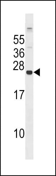 Polyclonal Rabbit anti-Human GPX8 Antibody (aa164-193, WB)