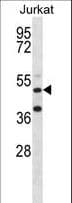 Polyclonal Rabbit anti-Human RBM22 Antibody (aa165-193, IHC, WB)