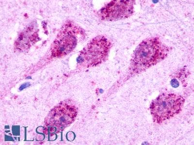 PathPlus™ GPR35 Antibody (Cytoplasmic Domain)