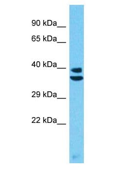 Polyclonal Rabbit anti-Human PRSS55 Antibody (aa223-272, WB)