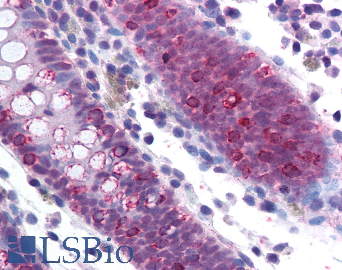 Polyclonal Rabbit anti-Human SF1 Antibody (aa517-566, IHC, WB)