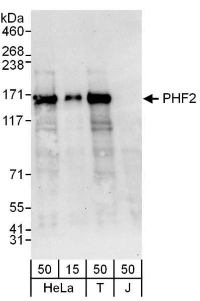 Polyclonal Rabbit anti-Human PHF2 Antibody (aa650-700, WB)