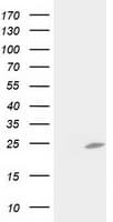 C1orf50 Antibody (clone OTI1F9)