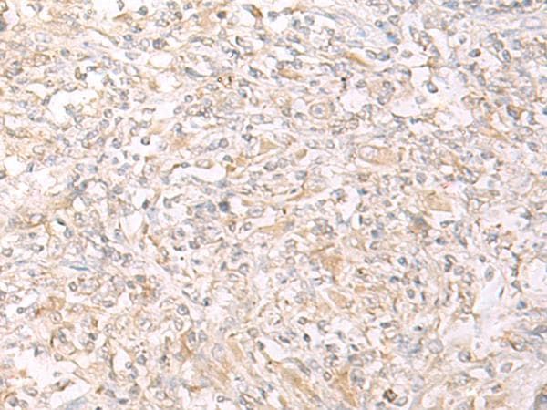 IL12B / IL12 p40 Antibody