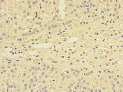 Polyclonal Rabbit anti-Human SHISA5 / SCOTIN Antibody (IHC)