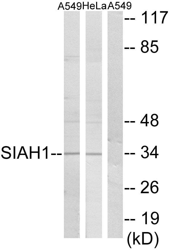 SIAH1 Antibody