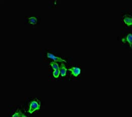 Polyclonal Rabbit anti-Human HDHD2 Antibody (IHC, IF)