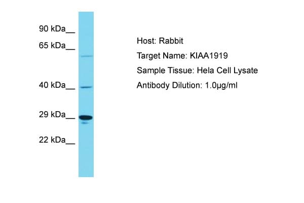 KIAA1919 / NAGLT1 Antibody (aa186-235)