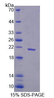 Human FAM3B Protein (Recombinant His-T7)