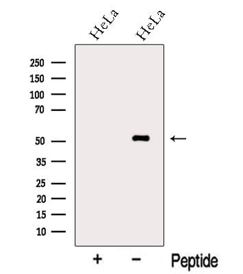 Polyclonal Rabbit anti-Human NAP1L4 Antibody (WB)