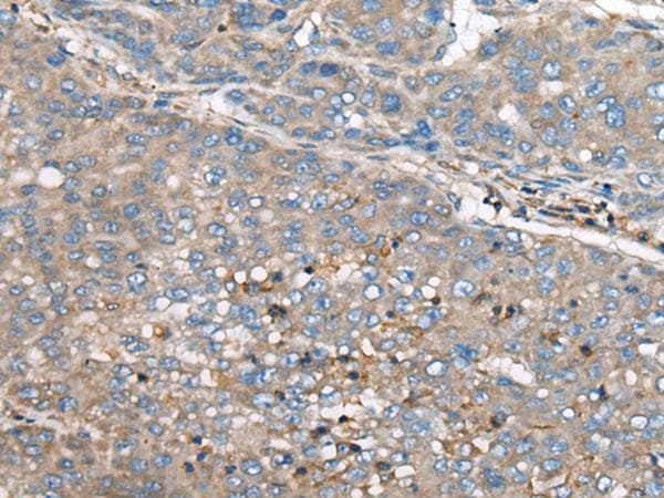 Polyclonal Rabbit anti-Human CED6 / GULP1 Antibody (IHC)