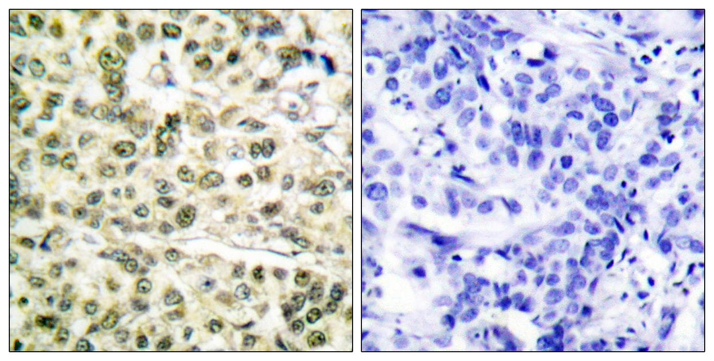 Polyclonal Rabbit anti-Human PCNA Antibody (IHC, WB)