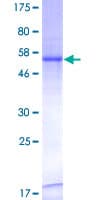 Human CTDSP2 Protein (Recombinant GST)
