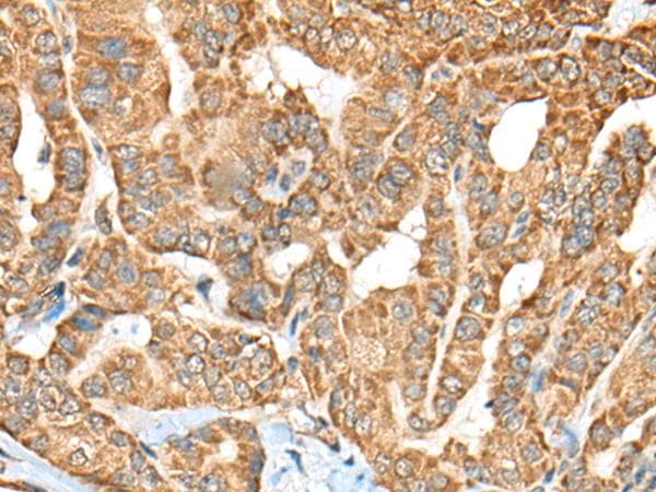 Complement C1R Antibody