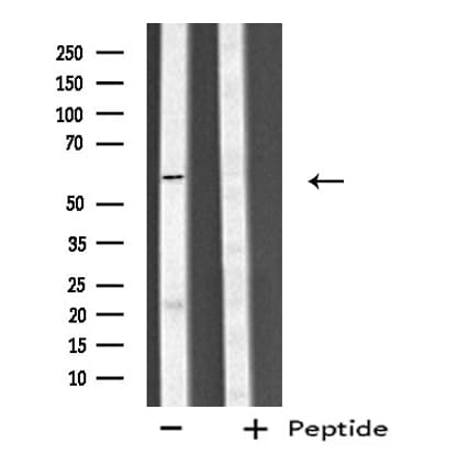 Polyclonal Rabbit anti-Human CYP4V2 Antibody (aa339-364, IHC, IF, WB)