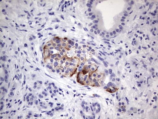 POMK / SGK196 Antibody (aa141-350, clone OTI2B10, Carrier-free)