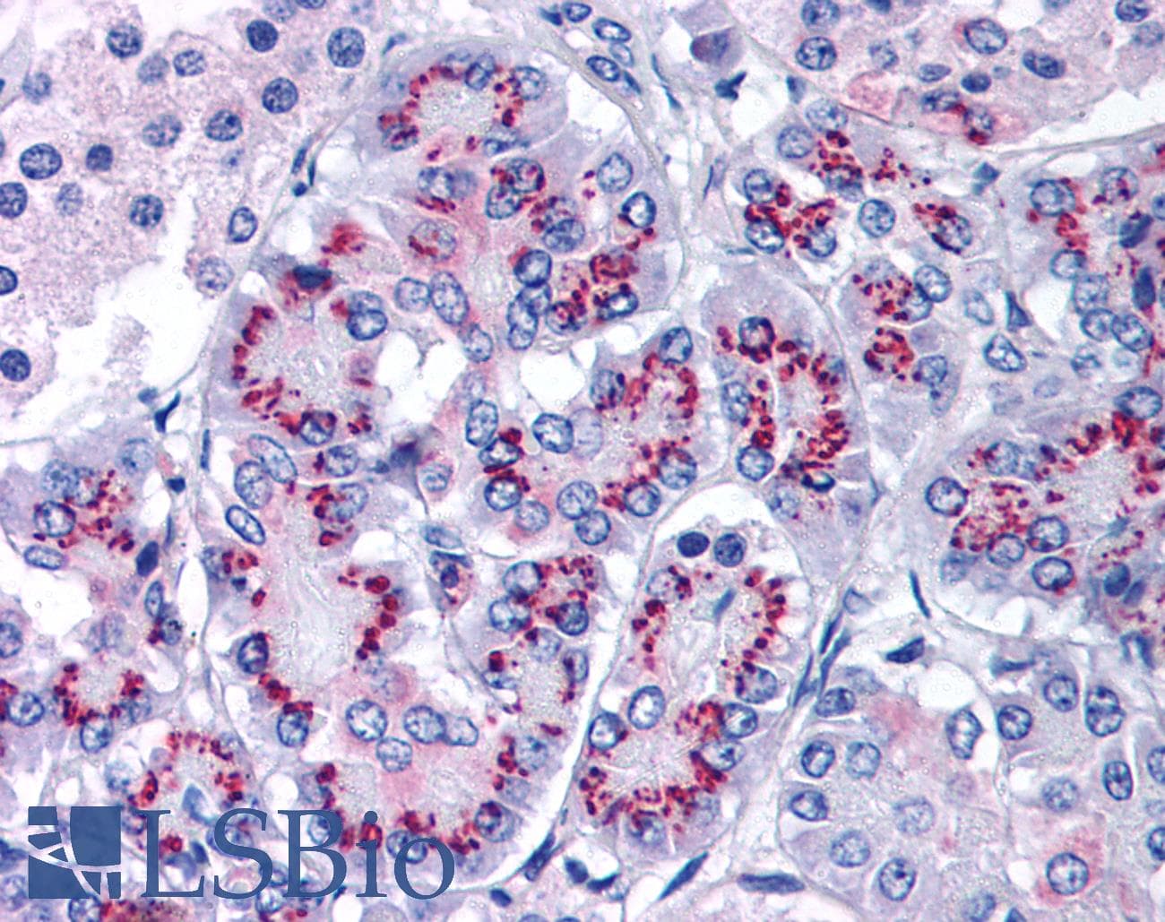 IHC-plus™ Monoclonal Mouse anti-Human CASP3 / Caspase 3 Antibody (clone CPP32 4-1-18, IHC, WB)