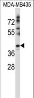 Polyclonal Rabbit anti-Human DNAJC28 Antibody (aa343-372, WB)