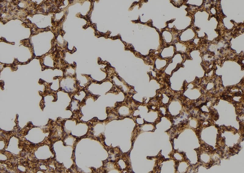 Polyclonal Rabbit anti-Human Tyrosinase Antibody (IHC, IF, WB)