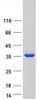 Human SNAP29 Protein (Recombinant Myc-DDK (Flag))
