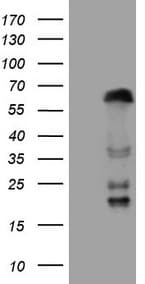 Monoclonal Mouse anti-Human Zfp105 / ZNF35 Antibody (clone OTI4D5, Carrier-free, aa1-258, IHC, WB)