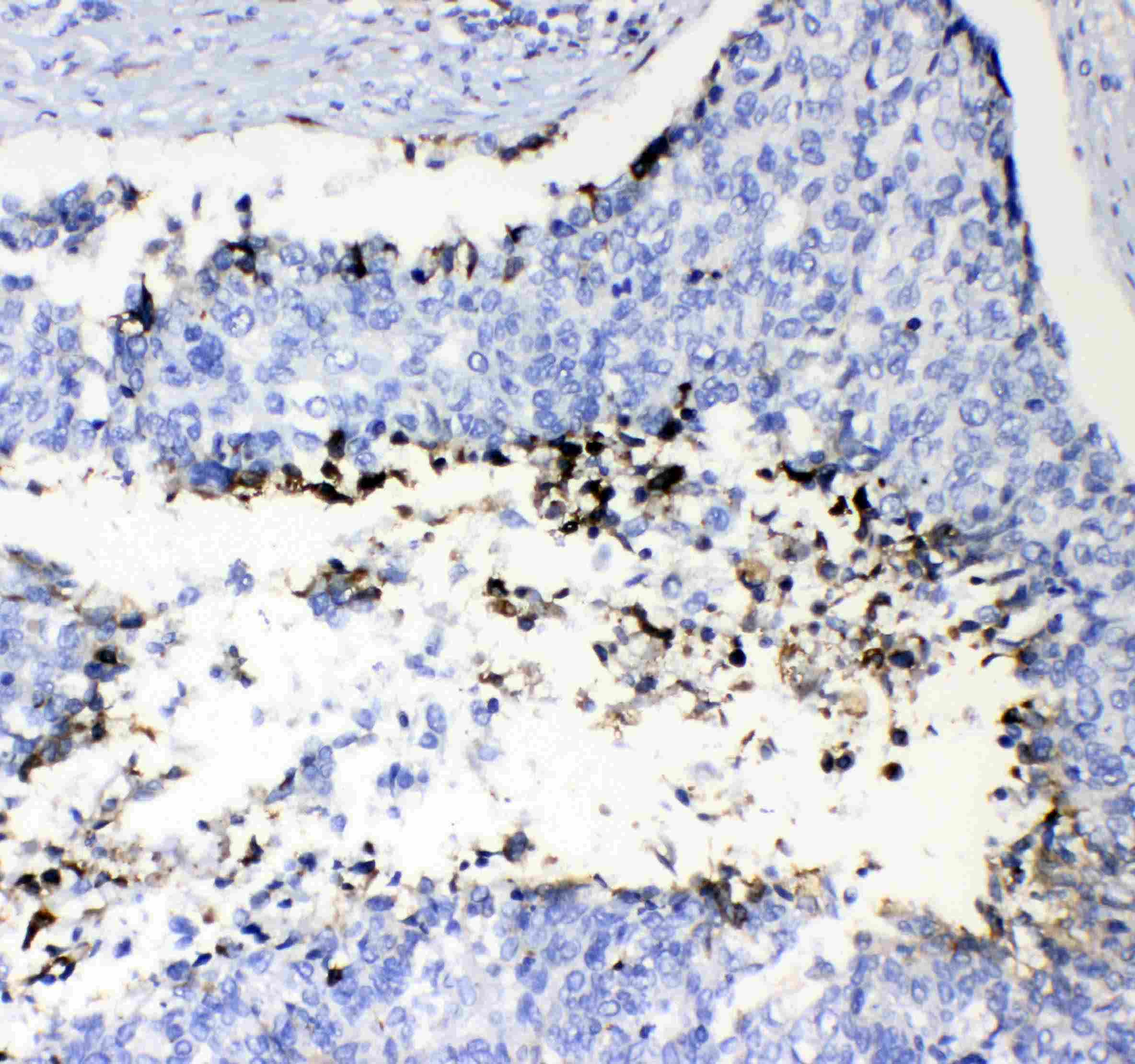 F2 / Prothrombin / Thrombin Antibody