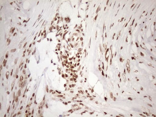 EXOSC1 / CSL4 Antibody (clone OTI4C7)