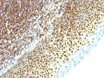 SUMO2 Antibody (clone SPM621)