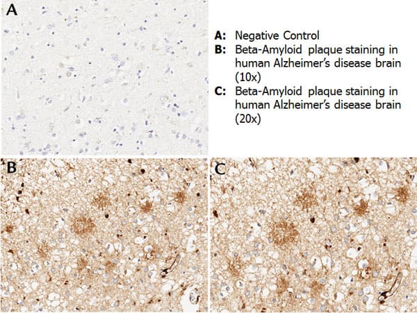APP / Beta Amyloid Precursor Antibody