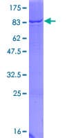 Human PGIS / PTGIS Protein (Recombinant GST)
