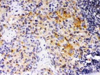 SKAP1 / SCAP1 Antibody