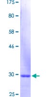 Human KRT3 / CK3 / Cytokeratin 3 Protein (Recombinant GST, N-terminus)