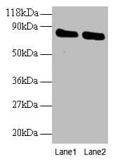 OTUB1 / OTU1 Antibody