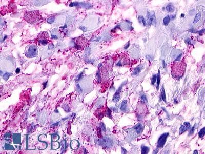 PathPlus™ GPRC5D Antibody (N-Terminus)