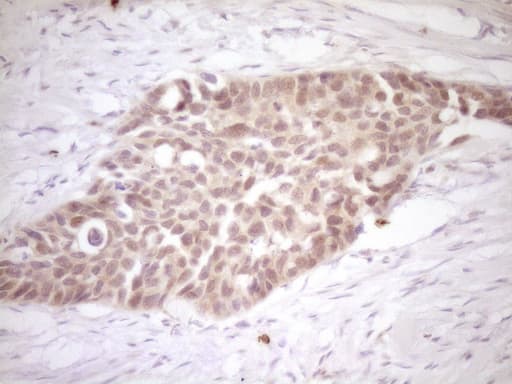 Monoclonal Mouse anti-Human CALCA Antibody (clone 2D12, IHC, WB)