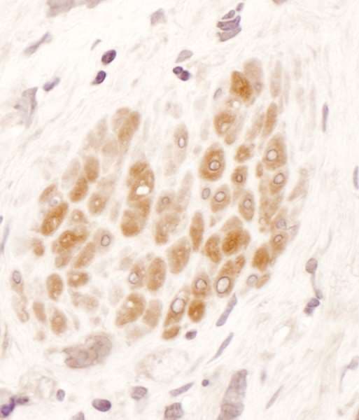 Polyclonal Rabbit anti-Human MTHFR Antibody (aa1-50, IHC)