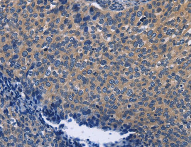 SYT17 Antibody