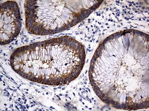 TRIM29 Antibody (aa1-352, clone OTI5C11)