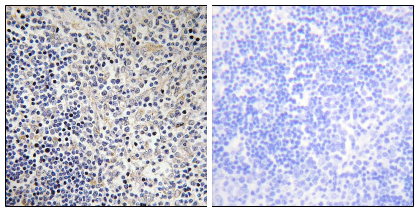 TP53AIP1 / p53 AIP1 Antibody