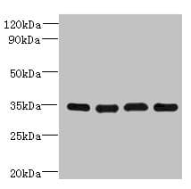 Polyclonal Rabbit anti-Human DNAJC17 Antibody (IHC, WB)