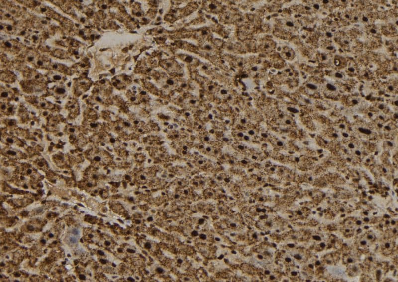 Polyclonal Rabbit anti-Human RANGAP1 Antibody (IHC, WB)