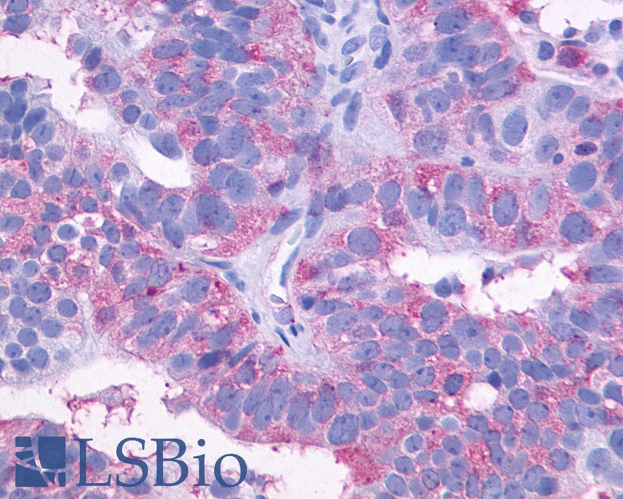 IHC-plus™ SIPR3 / EDG3 / S1P3 Antibody (C-Terminus)